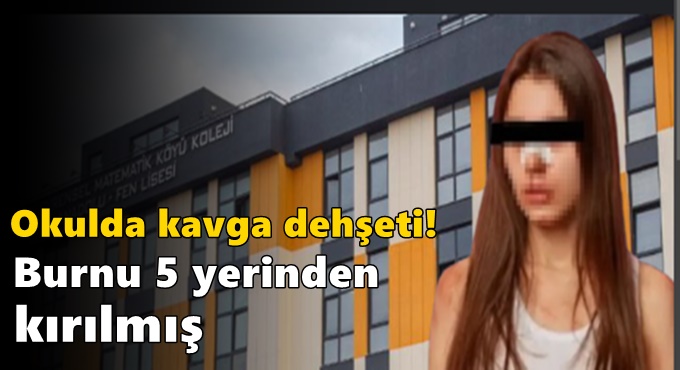 Burnu 5 yerinden kırılmış