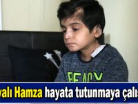 "Kelebek hastası" Hamza yaşama tutunmaya çalışıyor