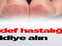 Sedef hastalığını ciddiye alın