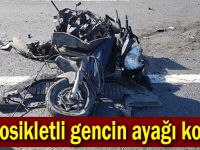 Motosikletli gencin ayağı koptu!