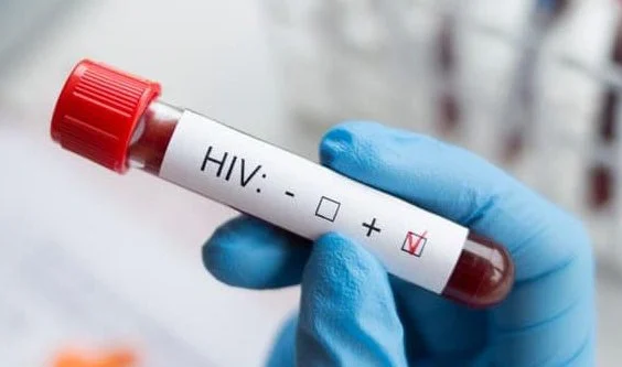 İstanbul’da HIV Pozitifliğini Saklayan Adama Hapis!