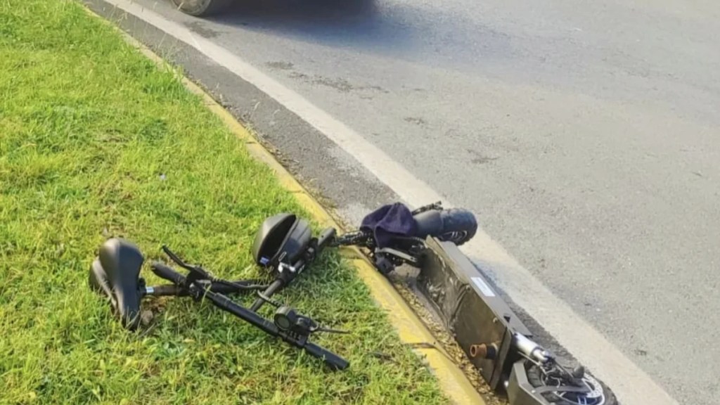 Servise çarpan scooter sürücüsü yaralandı!
